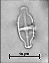 Achnanthidium exiguum (Grunow) Czarnecki,1994