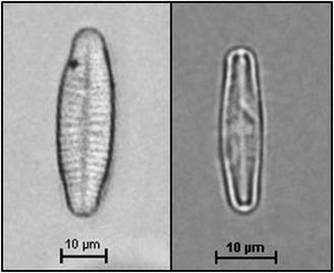 Achnanthidium minutissimum (Kützing) Czarnecki, 1994