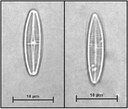 Achnanthidium pyrenaicum (Hustedt) Kobayashi