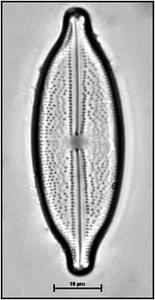 Anomoeoneis sphaerophora (Ehrenberg) Pfitzer, 1871