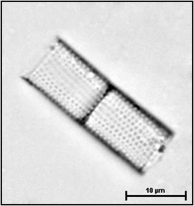 Aulacoseira granulata (Ehrenberg) Simonsen, 1979