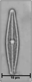 Brachysira vitrea (Grunow) Ross in Hartley, 1986