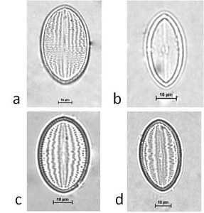 Cocconeis placentula Ehrenberg, 1838