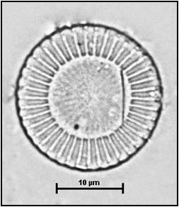 Cyclotella meneghiniana Kutzing, 1844