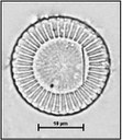 Cyclotella meneghiniana Kutzing, 1844