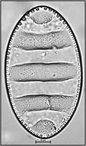 Cymatopleura elliptica (Brébisson ex Kützing) Smith, 1851