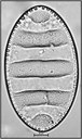 Cymatopleura elliptica (Brébisson ex Kützing) Smith, 1851