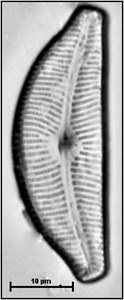 Cymbella tumida (Brébisson) Van Heurck, 1880