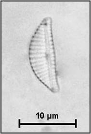 Encyonema minutum (Hilse) Mann in Round, Crawford & Mann, 1990