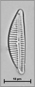 Encyonema silesiacum (Bleisch) Mann, 1990