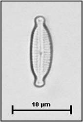 Encyonopsis minuta Krammer & Reichardt, 1997