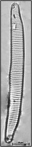 Eunotia pectinalis (Kützing) Rabenhorst, 1864