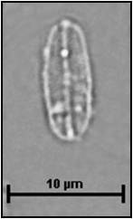 Fistulifera pelliculosa (Brébisson ex Kützing) Lange-Bertalot, 1997