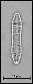 Fragilaria mesolepta Rabenhorst, 1861