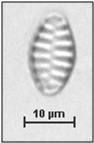 Fragilaria pinnata Ehrenberg, 1843