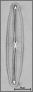 Frustulia vulgaris (Thwaites) De Toni, 1891