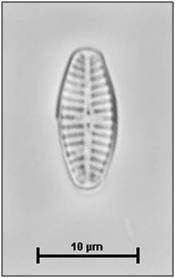 Geissleria acceptata (Hustedt) Lange-Bertalot & Metzelin, 1996