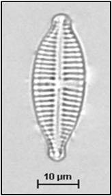 Gomphonema olivaceum (Hornemann) Brébisson, 1838