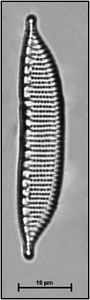 Hantzschia abundans Lange-Bertalot, 1993