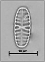 Hippodonta hungarica (Grunow) Lange-Bertalot, Metzeltin & Witkowski, 1996