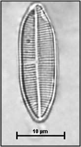 Lemnicola hungarica (Grunow) Round & Basson,1997