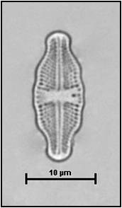 Luticola nivalis (Ehrenberg) Mann in Round, Crawford & Mann, 1990