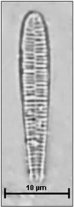 Meridion circulare var. circulare (Greville) Agardh, 1831